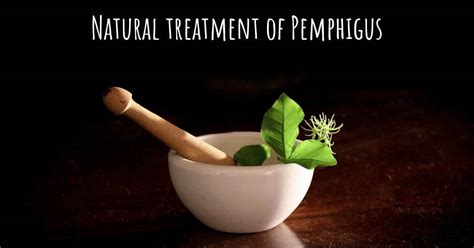 Is there any natural treatment for Pemphigus?