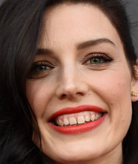 Celebrities With Crooked Teeth: Katy Perry, Rachel Weisz, and More