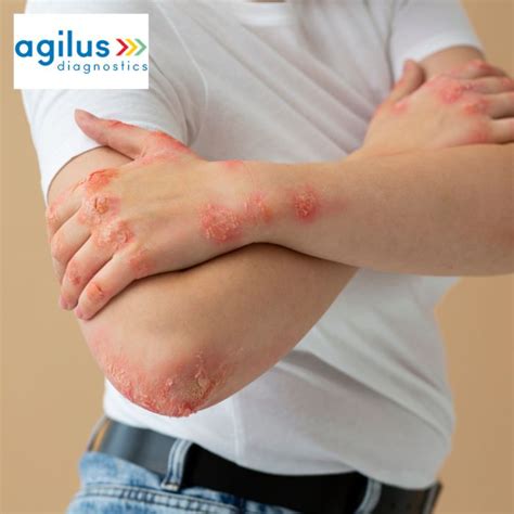 Agilus Diagnostics