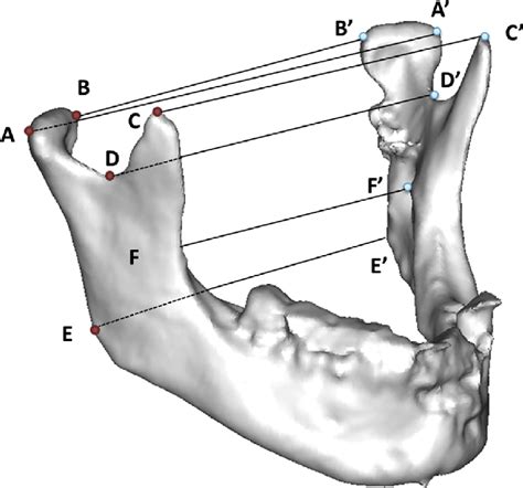 Landmarks. A: Lateral pole of the condyle. B: Medial pole of the ...