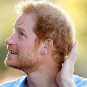 prince harry hairline – TrendRadars UK