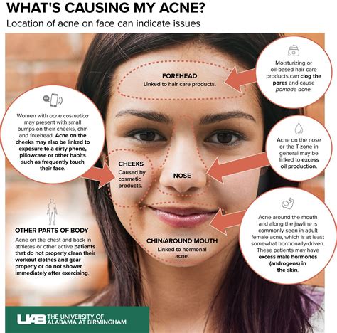 Perfect! Why Is My Body Breaking Out In Acne - Food Network B