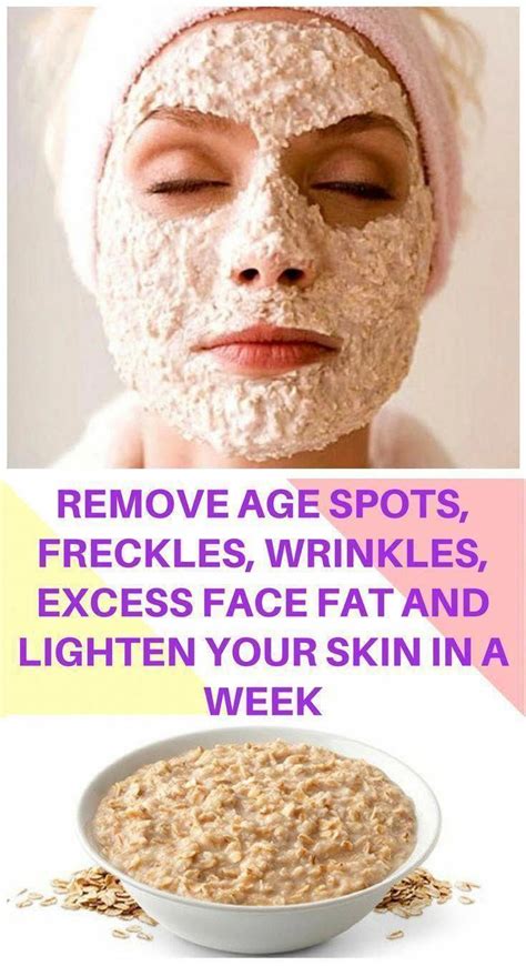 How to Naturally Remove Brown Spots on Face - Home Remedies | Age spot removal, Natural skin ...