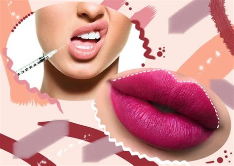 Lip Fillers Guide: Types of Lip Injections, Costs & Side Effects | Lip fillers, Lip injections ...