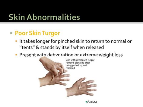 PPT - Physical Assessment Head, Neck, and Skin PowerPoint Presentation ...