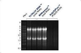 RNA Stabilization and Storage - RNAlater | Thermo Fisher Scientific - JP