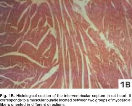 Interventricular Septum Histology