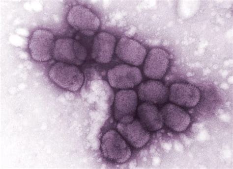 U.S. Moves Forward with Stockpiling of Second Smallpox Antiviral