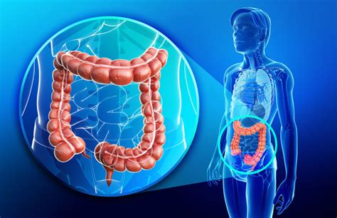 Colorectal surgery - Colorectal surgery overview - Dr. Markides