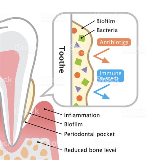 Plaquebiofilm-on-teeth-1 | Citrisafe