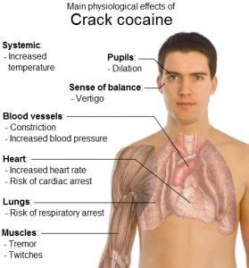 Crack cocaine addiction, information about the drug and it's abuse