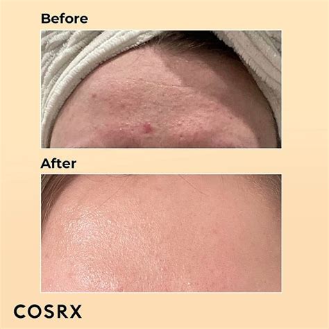 COSRX Snail Essence Could Repair Seriously Damaged Skin | Us Weekly