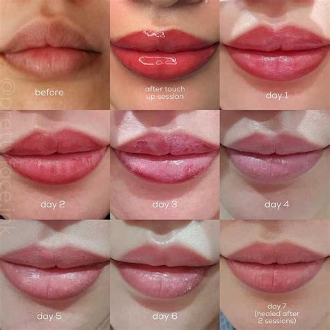 Permanent Makeup Lips Healing