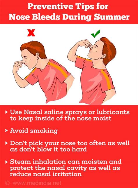 can nasal spray cause nose bleeds Cheaper Than Retail Price> Buy Clothing, Accessories and ...
