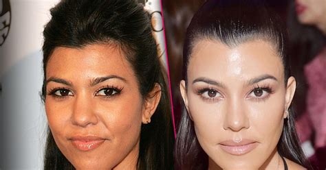 Kourtney Kardashian’s Massive Plastic Surgery Makeover Exposed By Top Docs