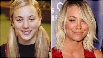 Celebrity Scope: Kaley Cuoco Secrets | Blog | Clinic Center