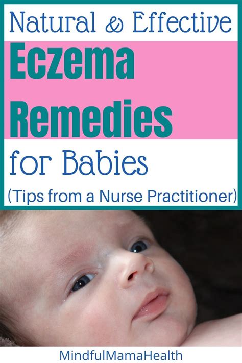 Safe and Effective Baby Eczema Natural Remedies - Mindful Mama Health ...