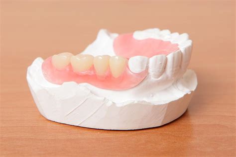 Dentures That Are Made According to Your Needs - Saskatoon Smiles