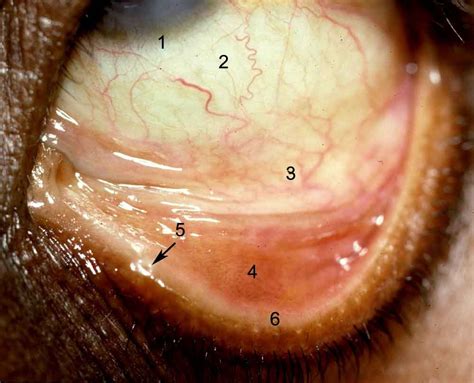 ANATOMY OF THE HUMAN EYE: Conjunctiva (answers)