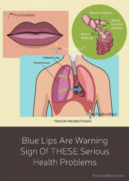 Blue Lips Are Warning Sign Of THESE Serious Health Problems