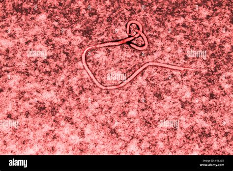 Ebola virus under microscope hi-res stock photography and images - Alamy