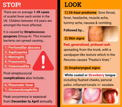 Information for Parents about Strep A - The Grange Group Practice