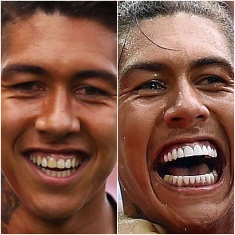 How much did Roberto Firmino spend on teeth whitening? – Thick Accent