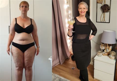 Steffi - I could never have imagined this weight loss despite lipedema | Foodpunk