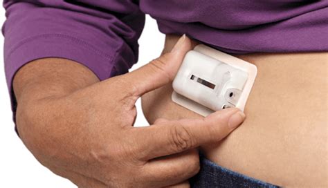 Insulin Patch Offers Alternative to Shots