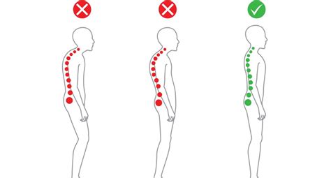 The Four Types of Posture – Which One Are You?