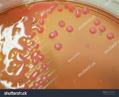 Klebsiella Pneumoniae Colony Morphology And Microscopic