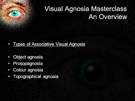 Visual agnosia overview - YouTube