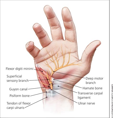 Ulnar Wrist Pain Causes