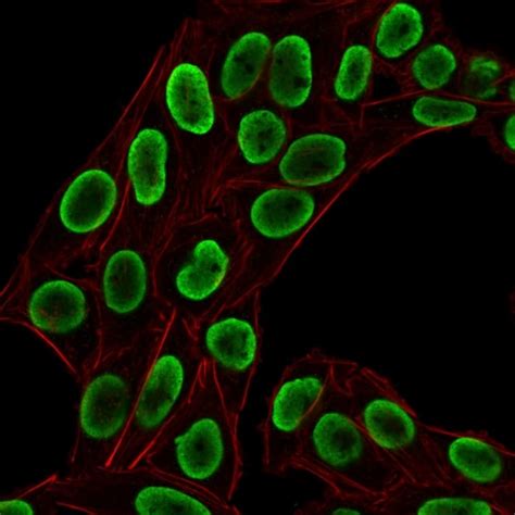 Recombinant Anti-Histone H1 antibody [HH1/1784R] (ab218418) | Abcam