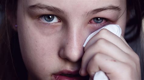 Eye Cold - Contagious Conjunctivitis You Ought to Know About