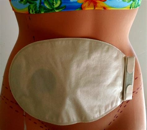 Colostomy Bag Covers For Women | IUCN Water