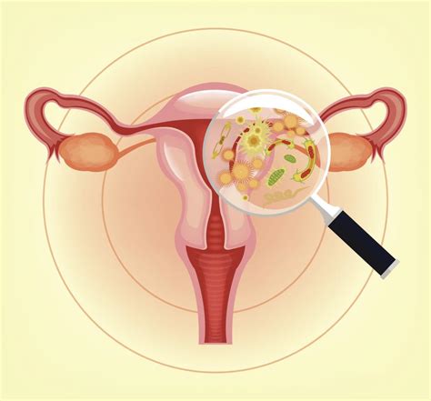 Vaginitis: Types, symptoms, causes, and treatment