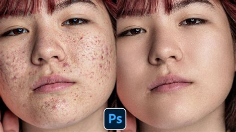 Face Retouching - Best Photoshop Tutorial | Skin Retouching 2023 ...