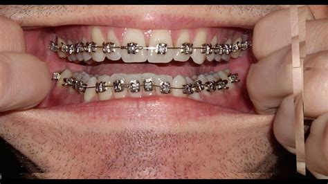 Nasty Teeth Images ~ Disgusting Mcdonalds | sunwalls