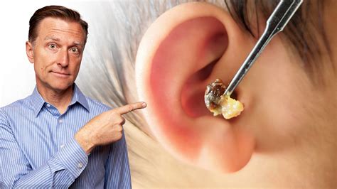 Foods That Cause Ear Wax—How to Reduce Buildup | Dr. Berg