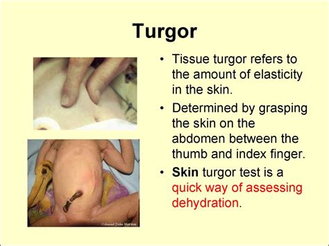 Functions of the skin - презентация онлайн