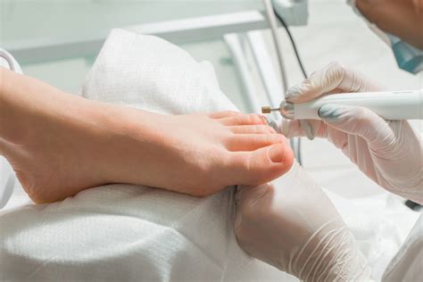 Toenail Fungus Laser Therapy - Podiatrist Near Me