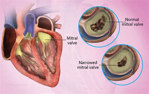 Health Condition : Symptoms, Causes, Treatment and More