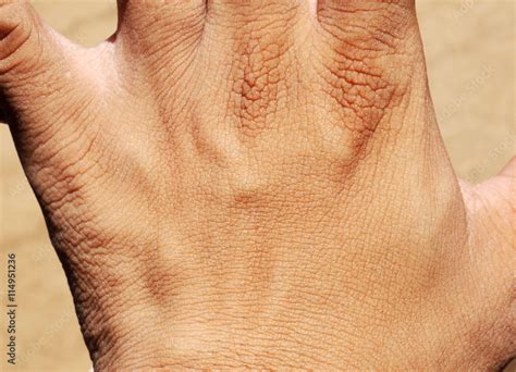 hand human skin texture Stock Photo | Adobe Stock