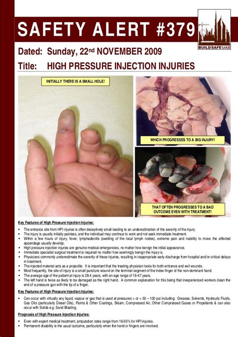 Safety Alert High Pressure Injection Injuries