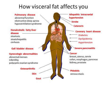 8 Strategies to Reduce Visceral Fat - Marsha Fenwick Nutrition