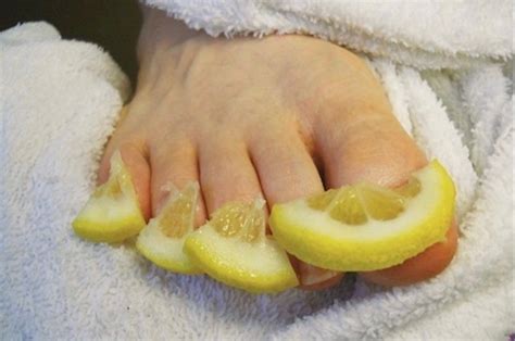 10 Effective Home Remedies For Getting Rid Of Toenail Fungus