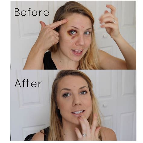 How to cover a black eye/shiner || Andrea Sawyer | Black eye remedies, Black eye makeup, Eye black