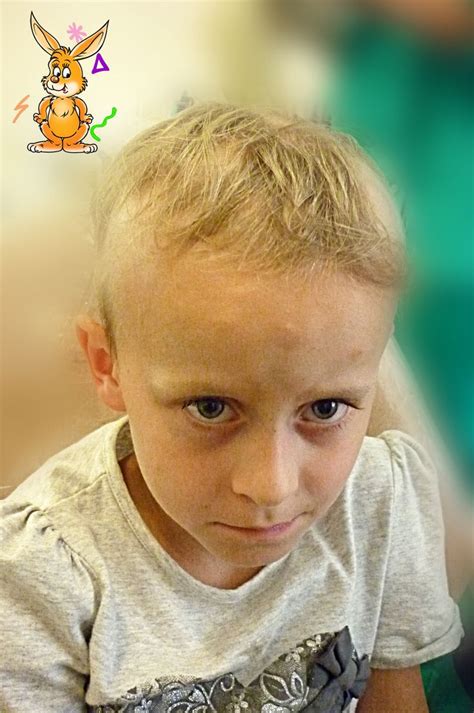 Pin on Children Hair Loss, Alopecia Areata, Alopecia Totalis, and Alopecia Universalis