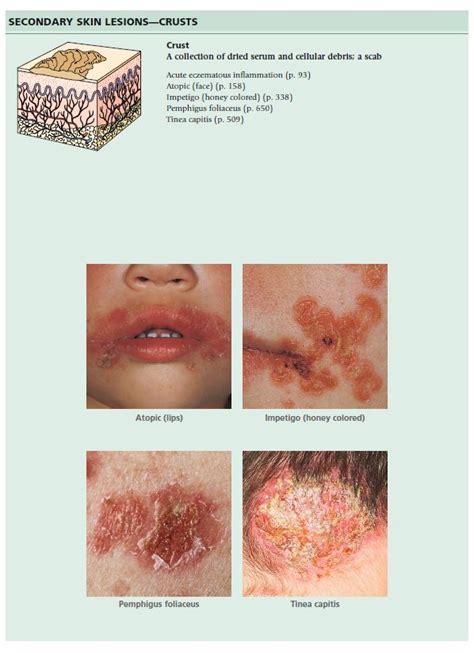 Diagnosis of skin disease